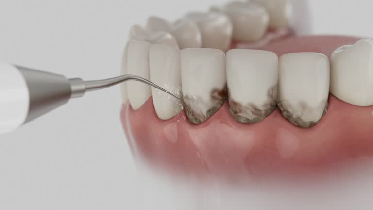 Reliable Dental Implants contractor in Fox Crossing, WI by Smile Center Dentistry